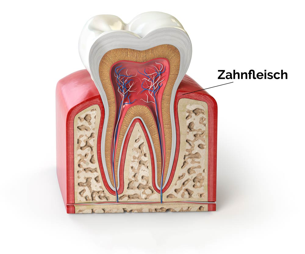 Zahnquerschnitt Zahnfleisch, Zahnarztpraxis in Mülheim Heißen