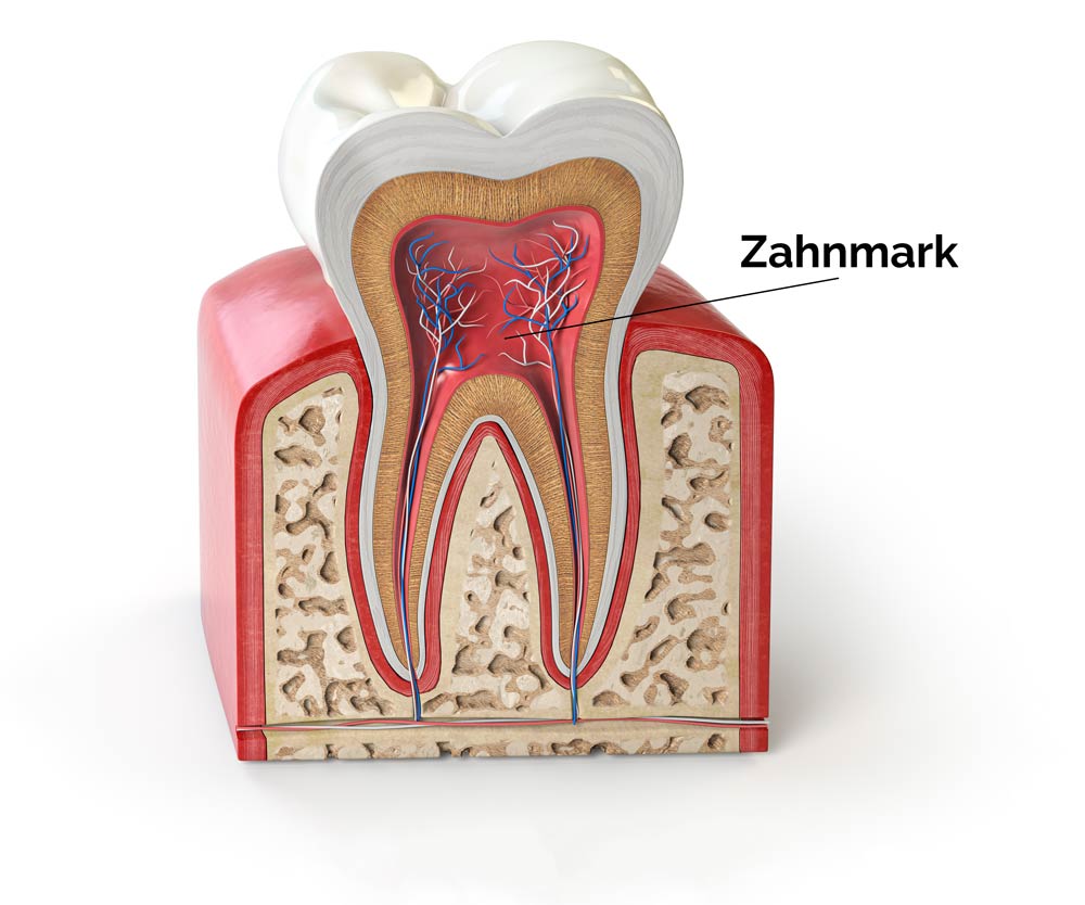 Zahnquerschnitt Zahnmark, Zahnarztpraxis in Mülheim Heißen