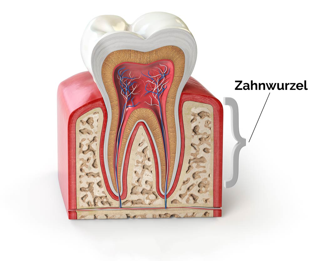 Zahnquerschnitt Zahnwurzel, Zahnarztpraxis in Mülheim Heißen